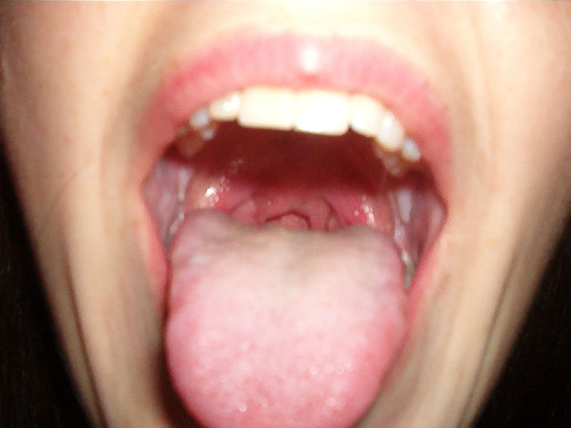 IM002175